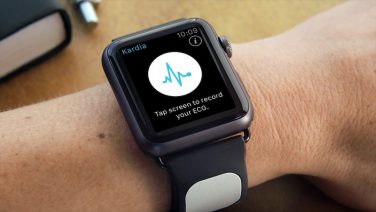 Kardia Band per monitorare il battito cardiaco con Apple Watch